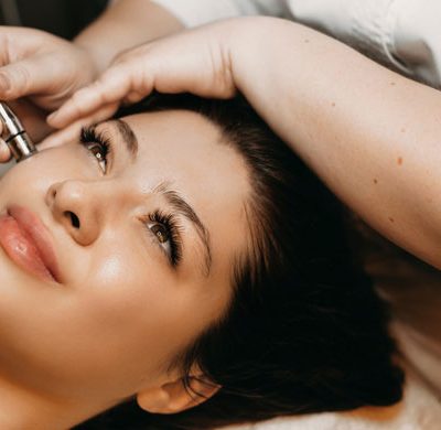 Microneedling